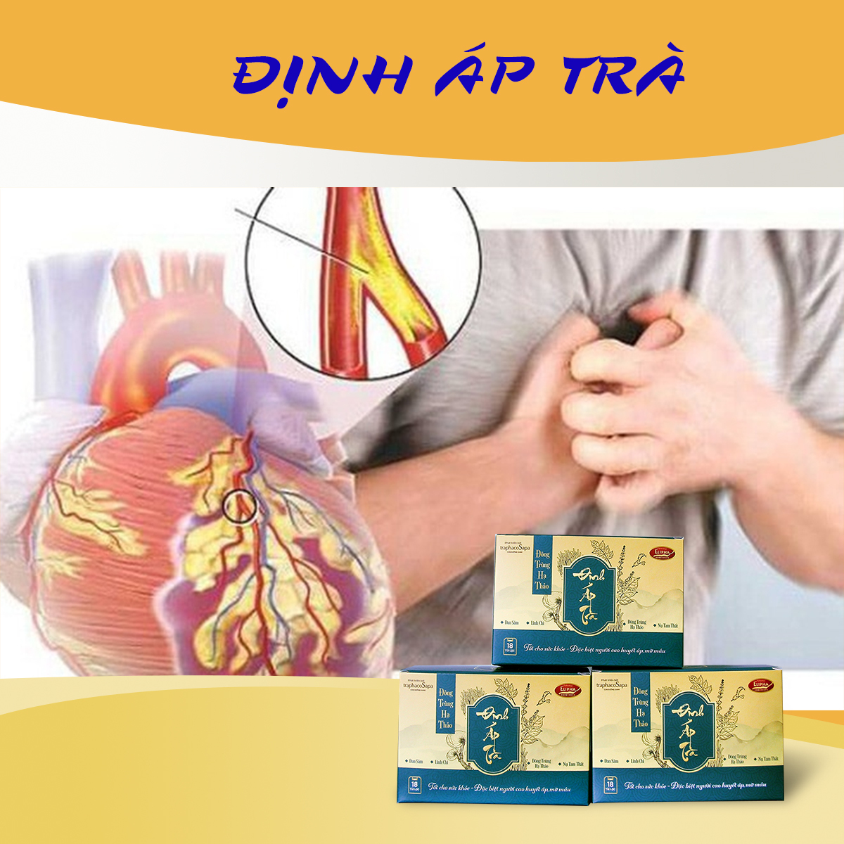 BIG SALE Đông Trùng Hạ Thảo Định Áp ƯU ĐÃI 70K